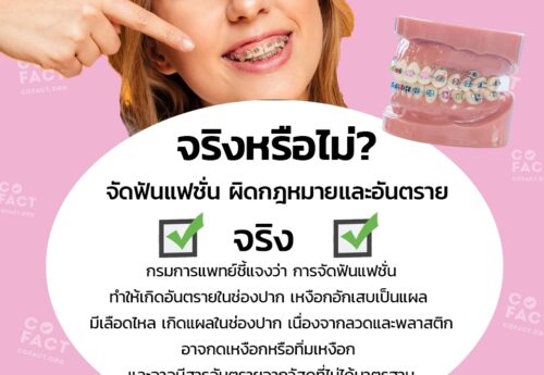 จริงหรือไม่? จัดฟันแฟชั่น ผิดกฎหมายและอันตราย