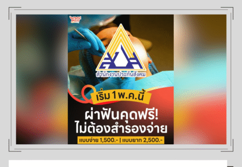 ผู้ประกันตนผ่าฟันคุดโดยไม่ต้องสำรองจ่ายหากรักษาในสถานพยาบาลที่ทำ MOU กับประกันสังคมเท่านั้น