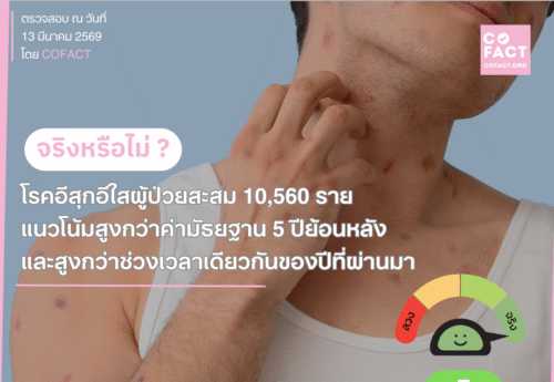จริงหรือไม่? ปี 2569 จำนวนผู้ป่วยอีสุกอีใสสะสมกว่า 1 หมื่นราย สูงกว่าค่ามัธยฐาน 5 ปีย้อนหลัง